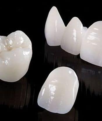 porcelain crowns chandler arizona dentist