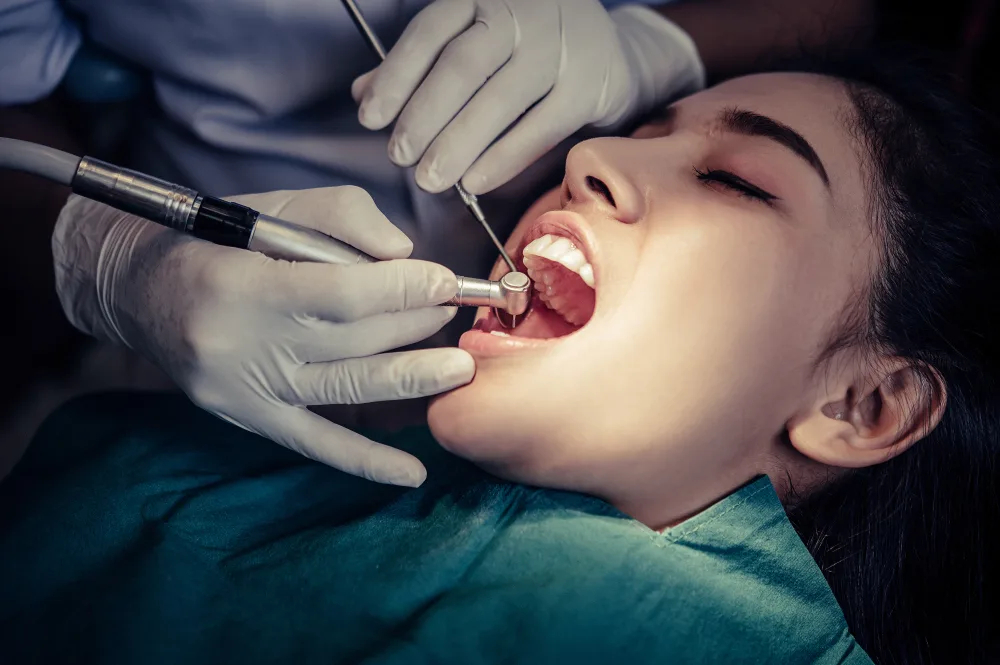 Root Canals