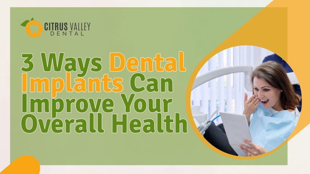 3 Ways Dental Implants Can Improve Your Overall Health