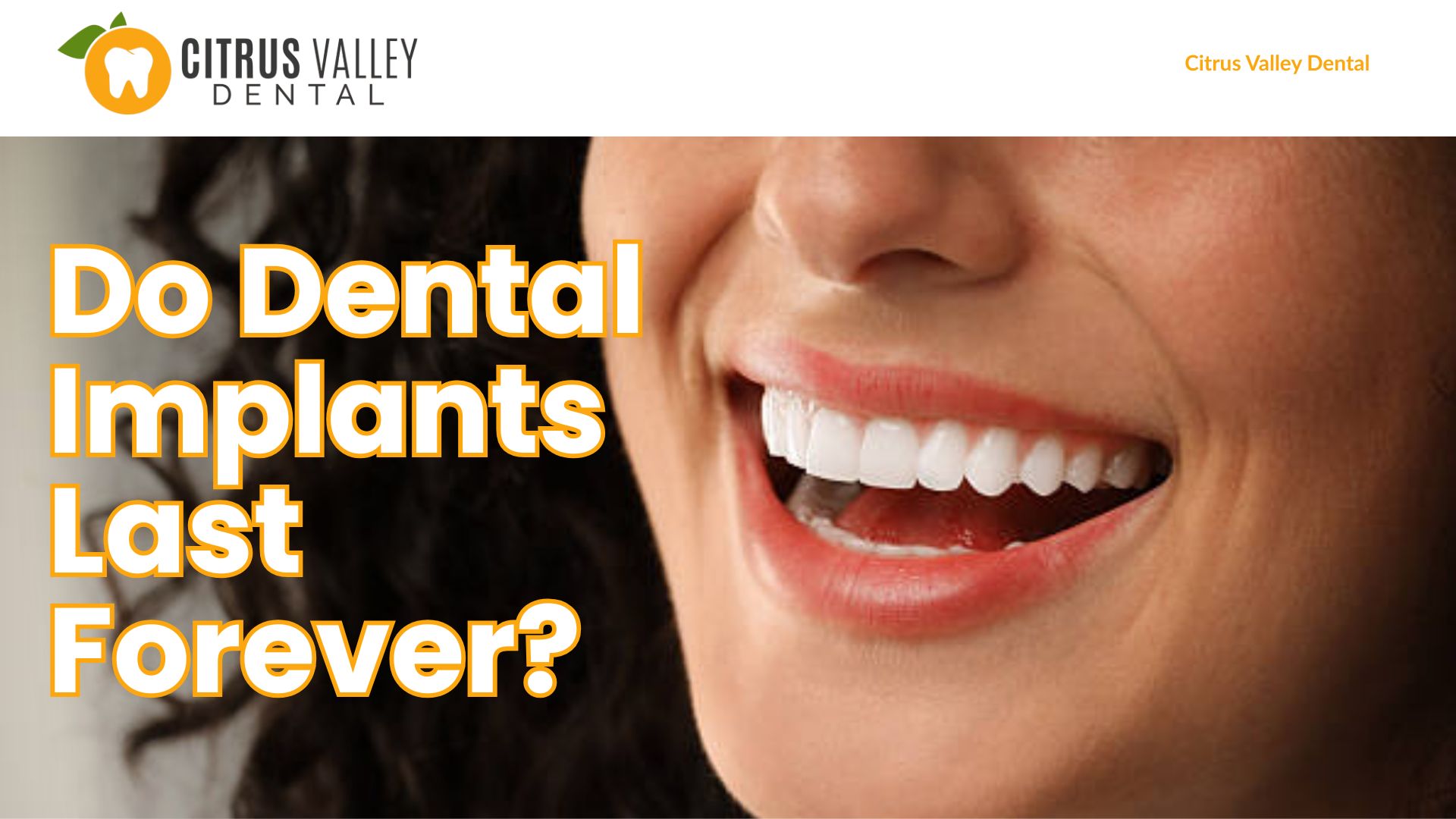 Do Dental Implants Last Forever?