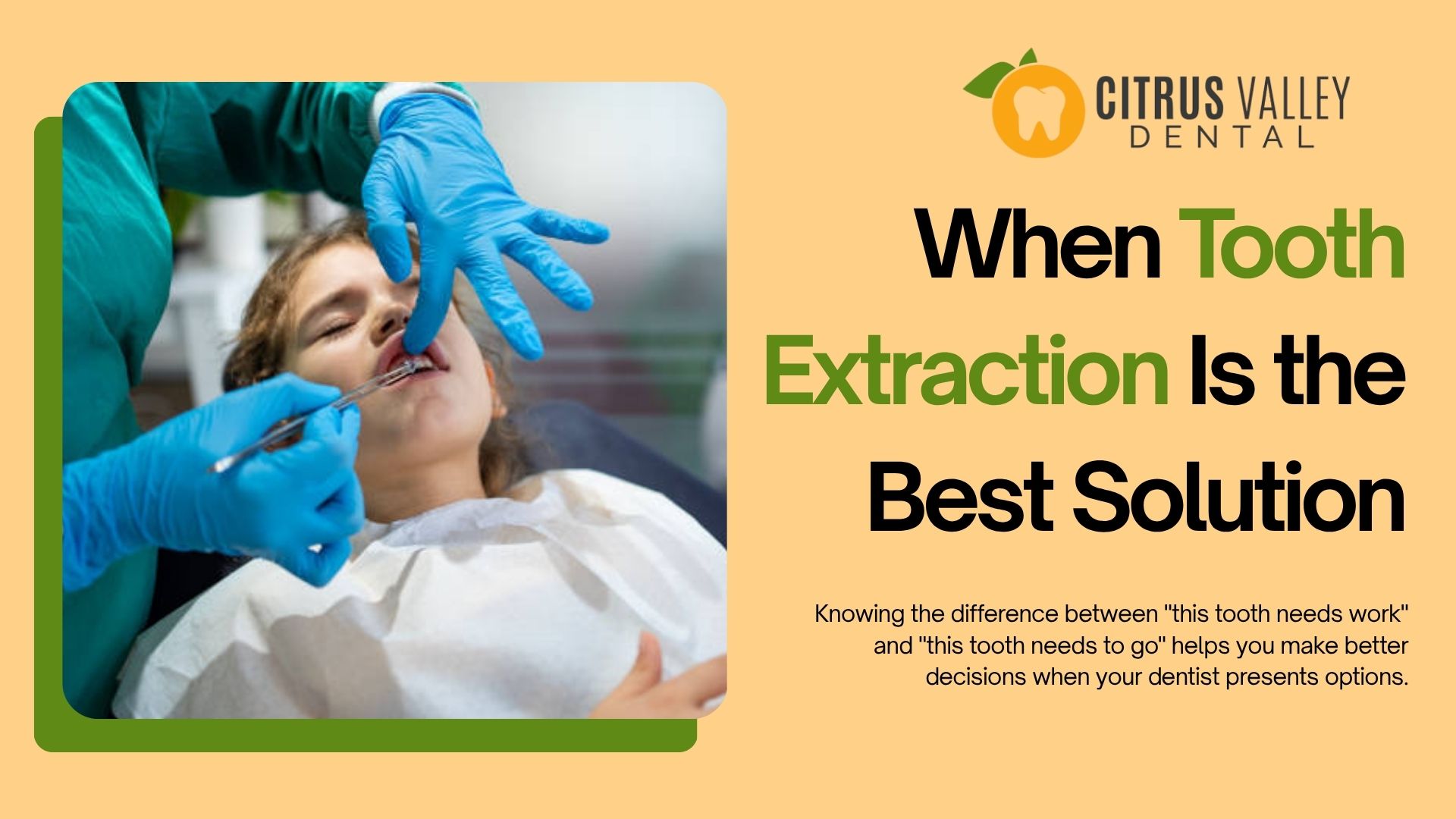 When Tooth Extraction Is the Best Solution