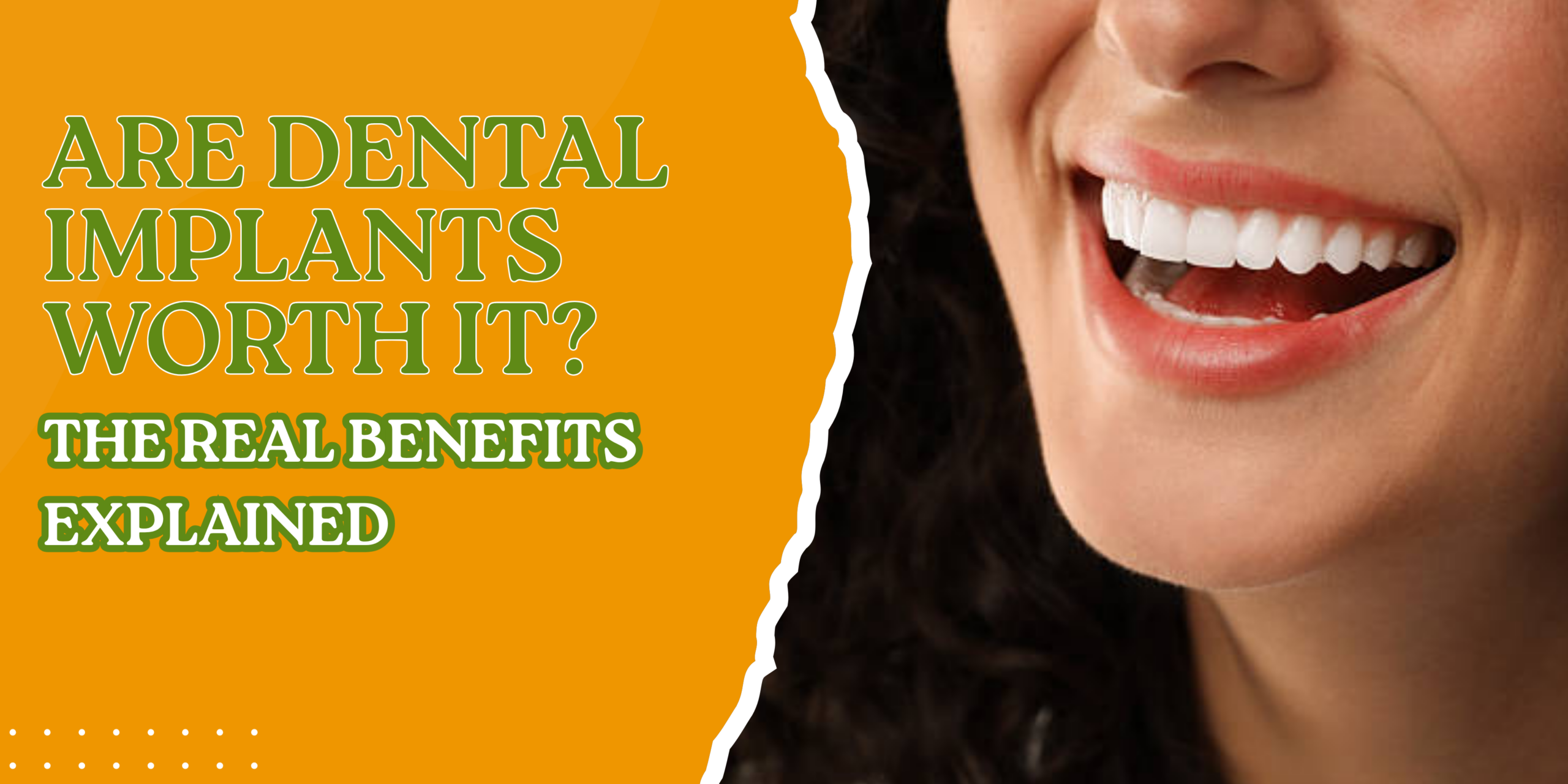 Are Dental Implants Worth It? The Real Benefits Explained